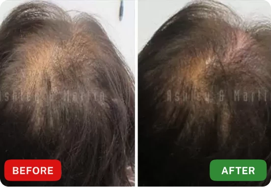 Roota Hair Serum Customer ~Robert M.